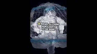 What Happens Inside an MRI Scanner? #Shorts #Radiology #mri #science #hydrationhero