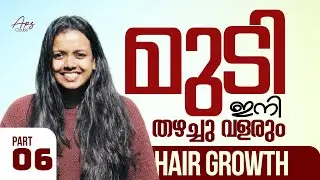 എന്റെ മുടി വളരാൻ ഞാൻ ചെയ്ത കാര്യങ്ങൾ  hair growth tips malayalam ,omega3 , haircare , hairfall