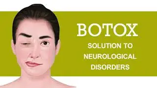 Botox - Solution To Neurological Disorders | Dr. Neeraja K | Guntur