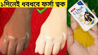 একদিনে ত্বক ধবধবে ফর্সা উজ্জ্বল হবে,কালো দাগ তুলে দেবে/instant skin whitening remedy/glow/fairness  