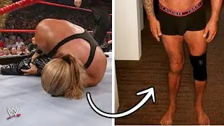 WWE Wrestlers Whose Bodies are Damaged Because of Wrestling