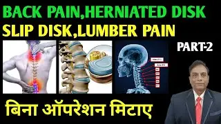 Back Pain । Herniated Disk । Slip Disk । Lumber Pain । बिना ऑपरेशन मिटाए