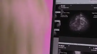 Breast Cancer screenings more affordable thanks to new Virginia Law