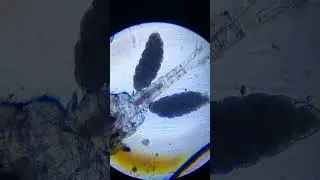 Eucyclops sampled from lake sediment