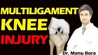 Multi Ligament Knee Injury // Dr. Manu Bora