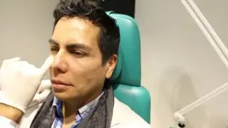 Quitar ojeras Rapido/ Relleno de Ácido Hialurónico