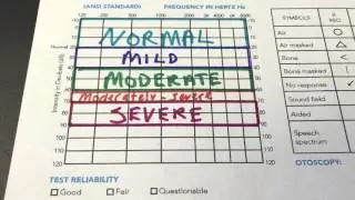How to Read Your Audiogram