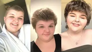 IT'S BEEN 6 MONTHS SINCE I SHAVED MY HAIR! | 6 MONTH HAIR UPDATE!! | Chloe Benson