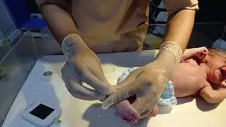 How to Check Random Blood Sugar (RBS) in a Newborn Baby#babycare #newbornbaby #cutebaby #cute #baby 