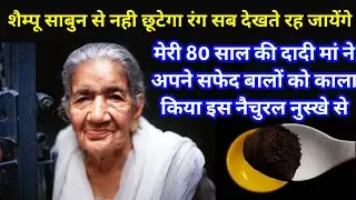 70 साल की उम्र में भी बाल काले ना हेयर डाई ना कलर सिर्फ 2 मिनट लगाओ सुखाओ // grey hair treatment,