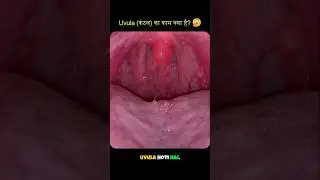 what is the function of Uvula?