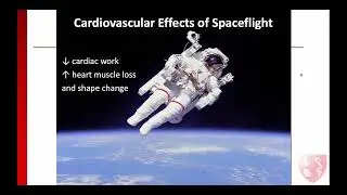 Cedars-Sinai Medical Center: Using Human Pluripotent Stem Cells to Model Effects of Spaceflight