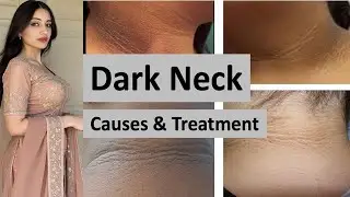 Dark Neck Treatment at Home in Urdu/Hindi | 100% Natural Remedies in Urdu