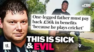 Amputee Told To Pay Back 36k In Disability Benefits