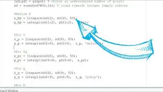 Extract PQRST points from ECG signal using ginput function | MATLAB