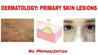 DERMATOLOGY:PRIMARY SKIN LESIONS: MACULE PATCH PAPULE PLAQUE VESICLE  #USMLE #MCC #CLINICAL MEDICINE