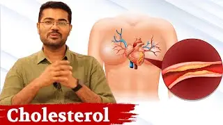Misconception About Cholesterol - Dr Manoj Johnson