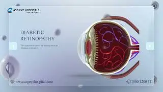 Complete Eye Care Under One Roof | Cataract, Retina, LASIK & More |a ASG Eye Hospitals