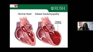 Long-Term Effects and Toxicities of Cancer Treatment on Cardiovascular Health