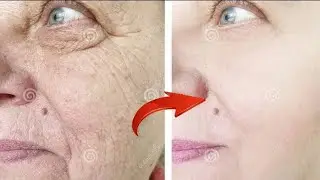 Как избавиться от морщин? Ей 70, а выглядит на 30! Это невероятно.