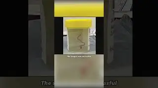 Worm lives in the human brain 😱 #shorts #discovery #science #mystery