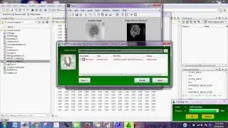 wound analysis matlab projects code