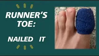 RUNNER'S TOE: Nailed It - Overcoming runner's toe