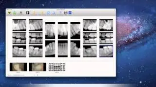 SuniMac Imaging Software: Innovative, user-friendly, designed specifically for Mac users