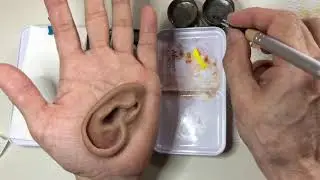 Staining on ear silicone prosthesis