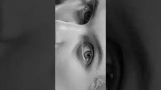 Fine Lines Filler | Fillmed Art Filler Fine Lines | Aesthetics Zone | Hyaluronic Acid Fillers