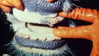 سلسلة الوقاية من الأمراض الحلقة 4 ( الحمي القلاعية)