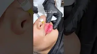 Beautiful lips 👄 #recommended#рек#top#beauty#aesthetic#lifting#lips#botox#skincare#fullface