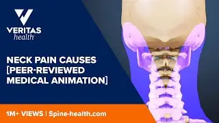 Neck Pain Causes
