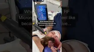 RF Microneedling | Does it Actually Work? | How Painful Is It?