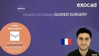 exocad exoplan 2021 WEBINAR - exoplan 3.0 Galway Chirurgie guidée (FR)