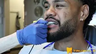 Braces vs Invisible Aligners | Candid Pro Clear Retainers by TruSmile are Revolutionary