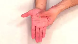Hd 2 Hand Scar Massage MFT