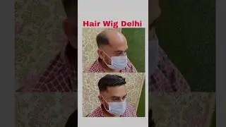 Hair Wig House Delhi | Rohtak | 9996900795 | Wigs Hair Delhi Price
