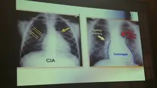 Cardiopatias cong&eacute;nitas