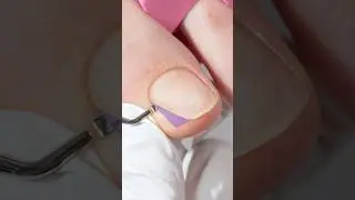 Acrylic powder thumb nail repair✨