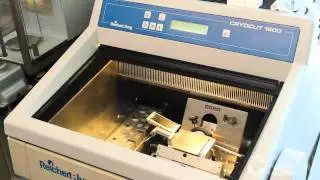 Tissue Imaging with Mass Spectrometry