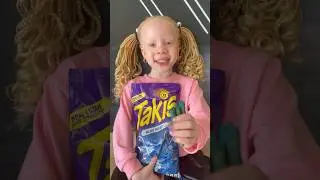 Lyric Tries Blue Takis😰 #shorts