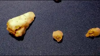 Thermal Gold Prospecting, Prospezione termica dell'Oro.