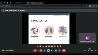 INTERPRETACI&Oacute;N DEL HEMOGRAMA DE SERIE BLANCA. Bioqui cl&iacute;nica.