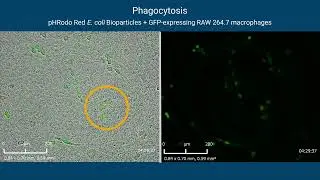 Real-time Phagocytosis Assays with RTCA eSight