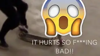 SCOOTER DAD DESTROYS ANKLE!!!! FUNNY SCOOTER FAIL!!!