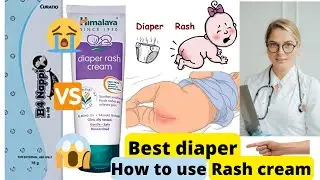 Himalaya diaper rash cream review|Best diaper rash creams|B4 nappi cream|#b4nappi