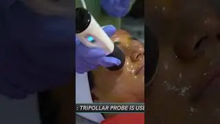 Oxygeneo 3 in 1 Superfacial | How Does it Works? | Dr. Avanti Pedamkar | Skin Specialist in Pune