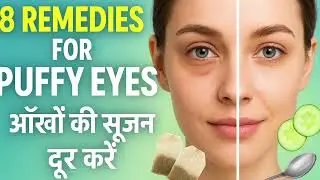 Home Remedies for Puffy Eyes|आँखों की सूजन दूर करने के लिए घरेलू उपाय #viralvideo #vjain84 #skincare