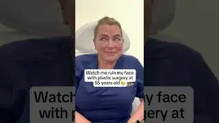 55 Year Old Facelift Update: Does She Regret it? 😓